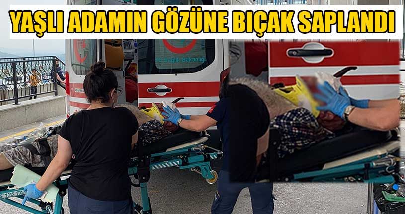 Gözüne Saplanan Bıçak İle Hastaneye Geldi