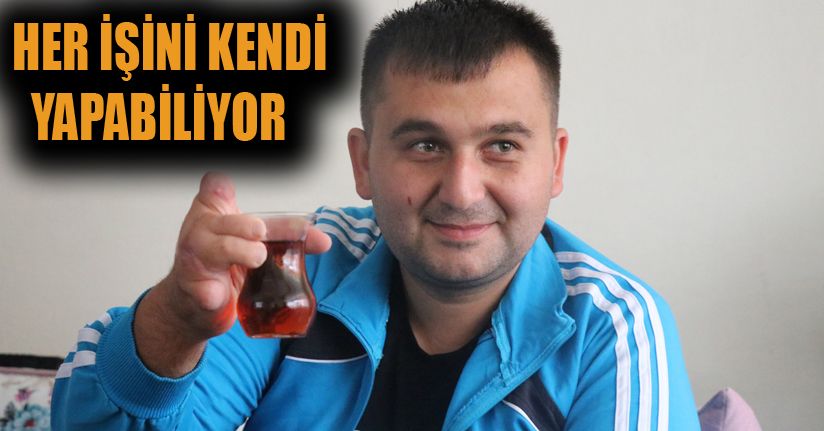 İş kazasında kaybettiği el parmaklarının yerine ayak parmakları nakledildi