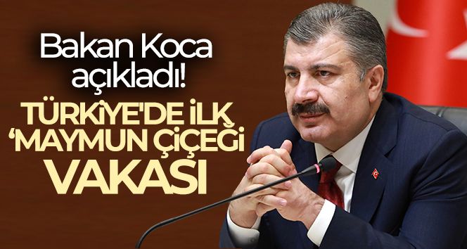 Bakan Koca açıkladı! Türkiye'de ilk 'Maymun Çiçeği' vakası