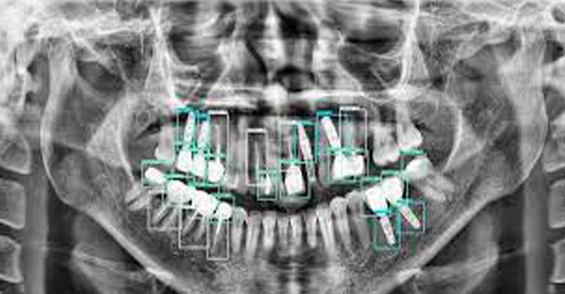 Diş hekimliğinde yapay zekâ uygulamaları