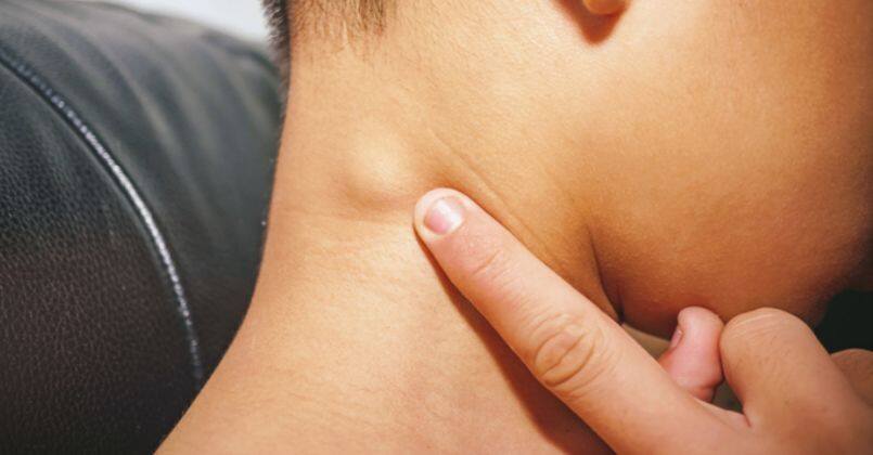 Lenfomada erken teşhis hayat kurtarıyor