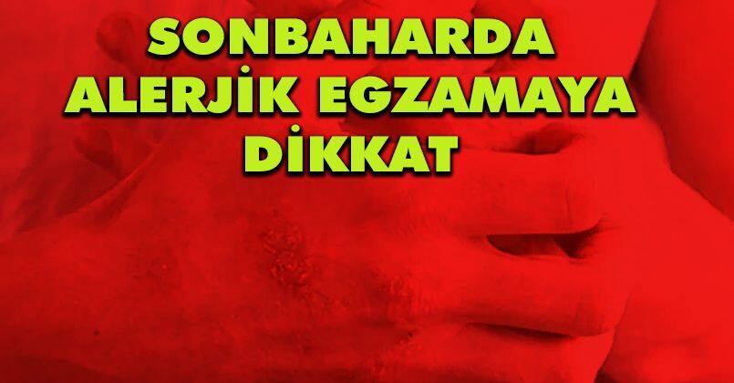 Sonbaharda alerjik egzamaya dikkat