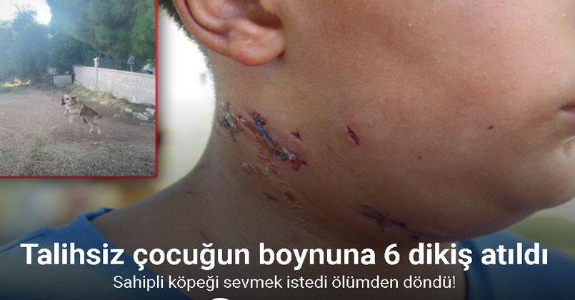 Köpek saldırısına uğrayan 10 yaşındaki çocuk ölümden döndü