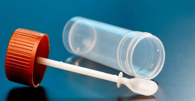 Sindirim bozukluğu tespiti için elastaz testi