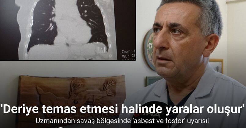 Uzmanından savaş bölgesinde ‘asbest ve fosfor’ uyarısı