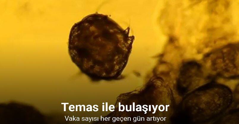 Temas ile bulaşıyor, vaka sayısı her geçen gün artıyor