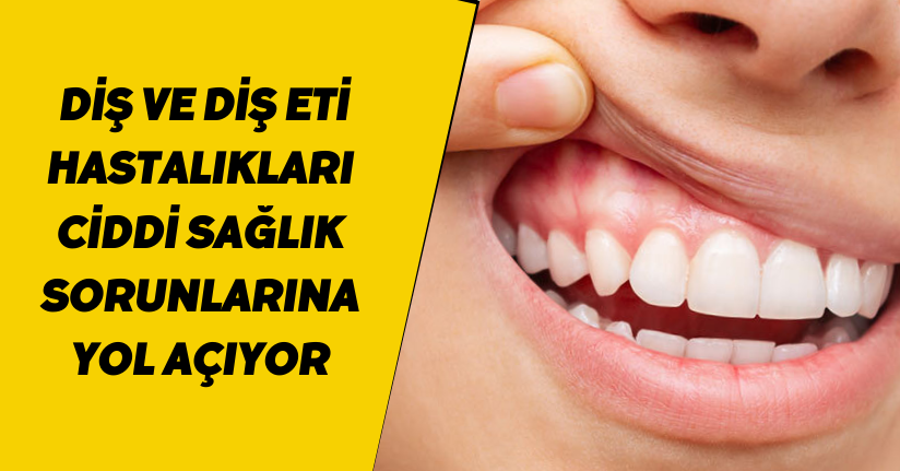 Diş ve diş eti hastalıkları ciddi sağlık sorunlarına yol açıyor