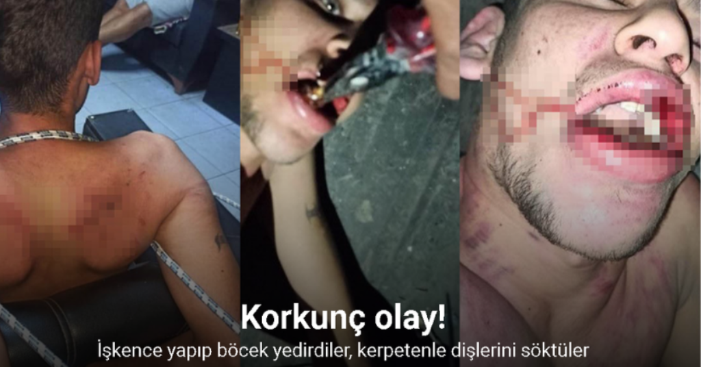 İşkence yapıp böcek yedirdiler, kerpetenle dişlerini söktüler