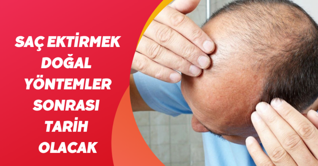 Saç ektirmek, doğal yöntemler sonrası tarih olacak