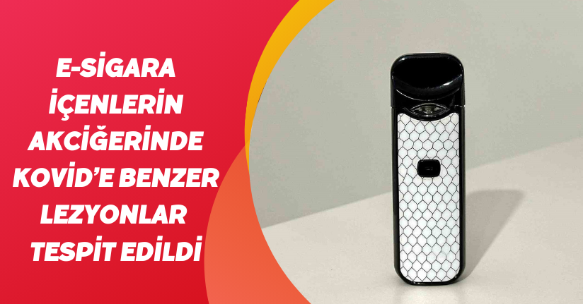 E-sigara içenlerin akciğerinde Kovid’e benzer lezyonlar tespit edildi