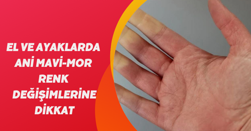 El ve ayaklarda ani mavi-mor renk değişimlerine dikkat