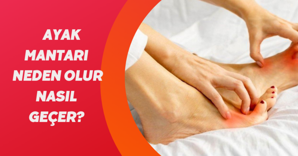 Ayak mantarı neden olur, nasıl geçer? 