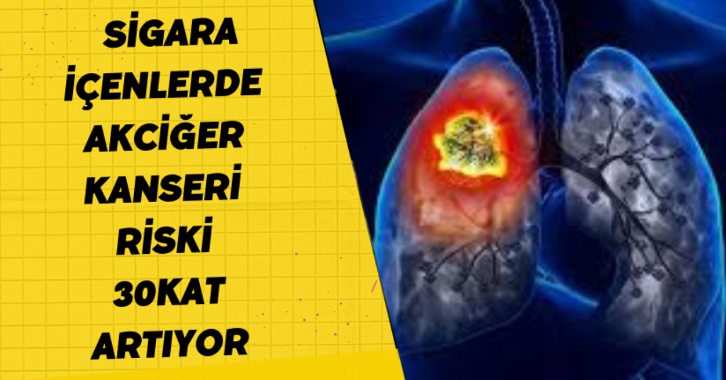 Sigara içenlerde akciğer kanseri riski 30 kat artıyor