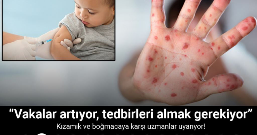 Kızamık ve boğmacaya karşı uzmanlar uyarıyor