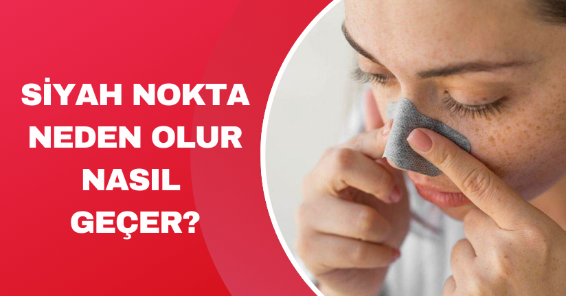 Siyah nokta neden olur, nasıl geçer?