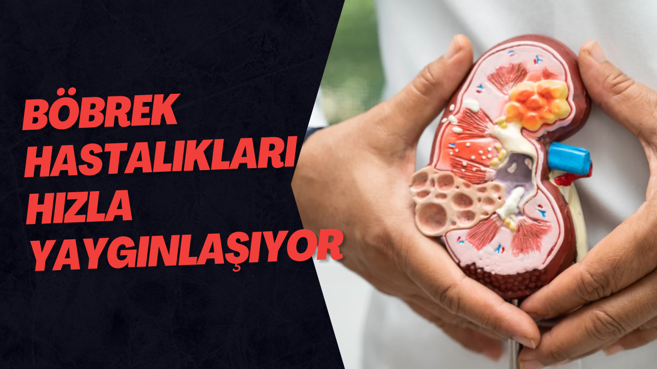 Böbrek Hastalıkları Hızla Yaygınlaşıyor