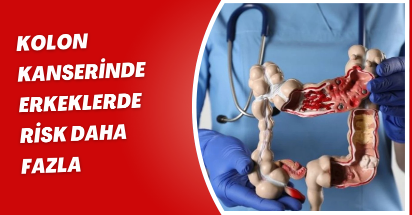 ‘Kolon kanserinde erkeklerde risk daha fazla