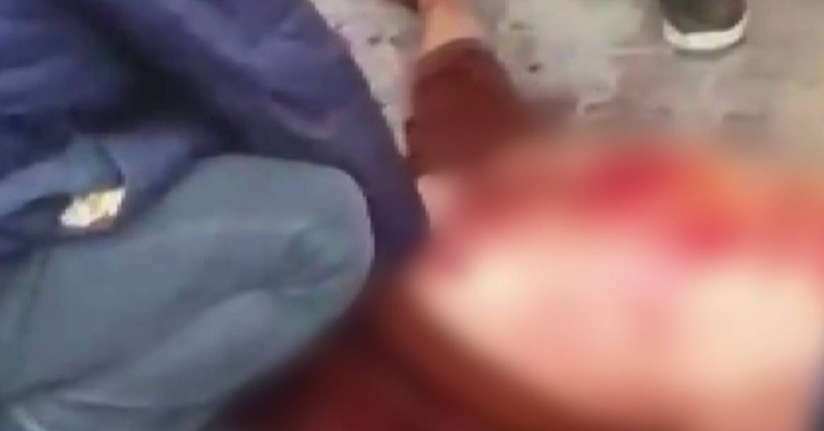 Gaziantep’te çocukların kavgasına aileler karıştı: 1 ölü, 2 yaralı