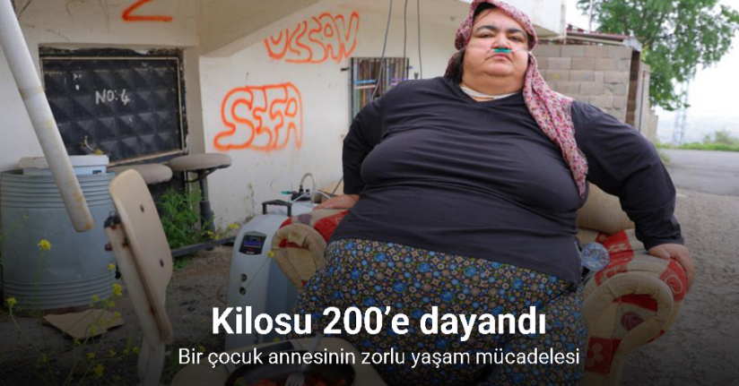 Bir çocuk annesinin zorlu yaşam mücadelesi: Kilosu 200’e dayandı