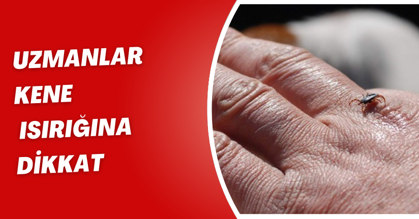 Uzmanlar; 