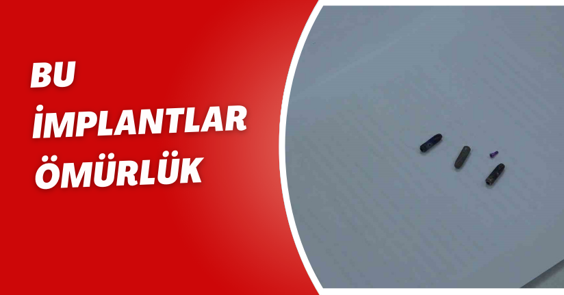 Bu implantlar ömürlük