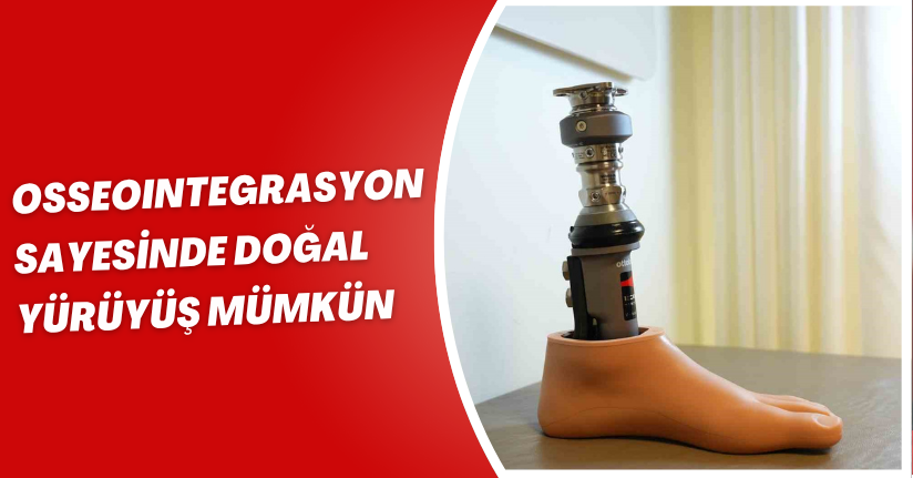 Osseoıntegrasyon sayesinde doğal yürüyüş mümkün