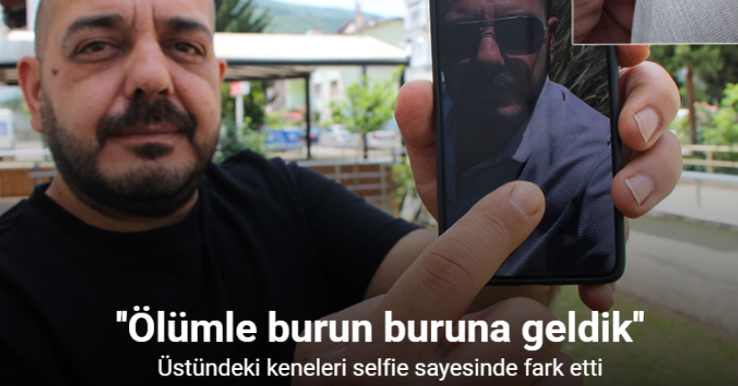Üstündeki ölümcül keneleri selfie sayesinde fark etti