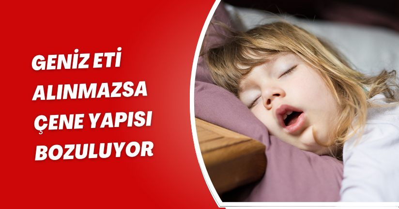 Geniz eti alınmazsa çene yapısı bozuluyor