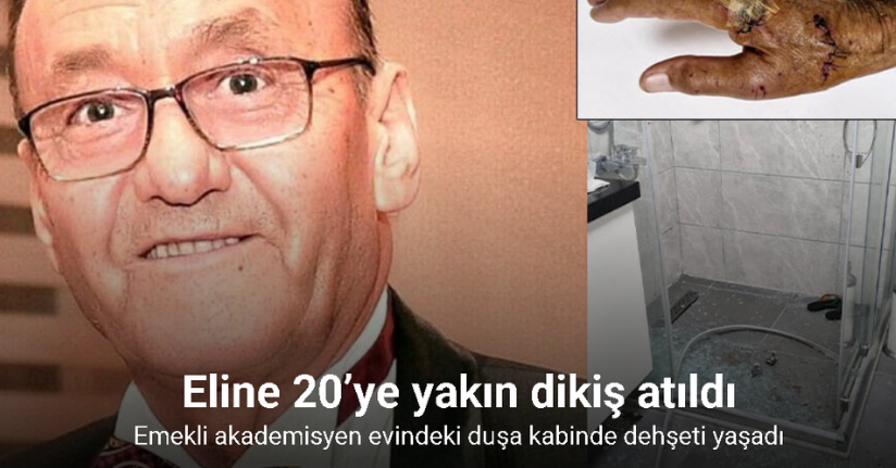 Duşa kabin patladı, eline 20’ye yakın dikiş atıldı