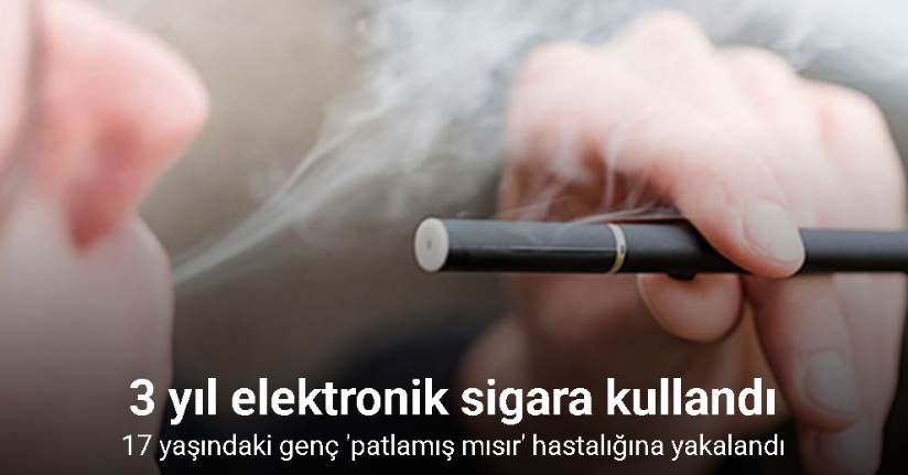ABD'de 3 yıl elektronik sigara kullanan genç, 