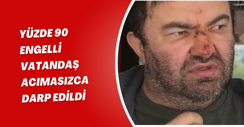 Yüzde 90 engelli vatandaş acımasızca darp edildi