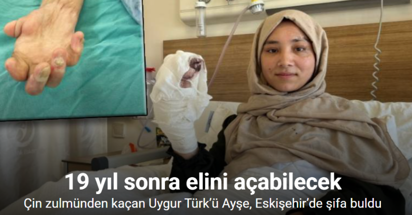 Çin zulmünden kaçan Uygur Türk’ü Ayşe, Eskişehir’de şifa buldu