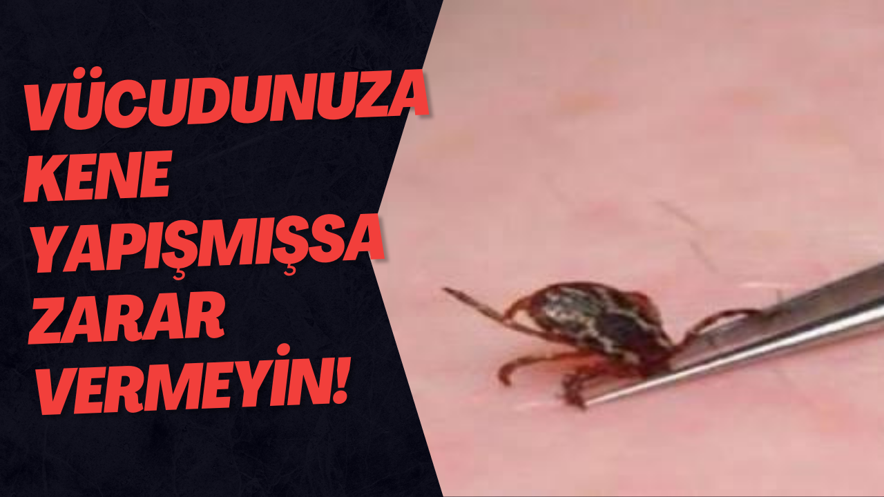 Vücudunuza Kene Yapışmışsa Zarar Vermeyin!