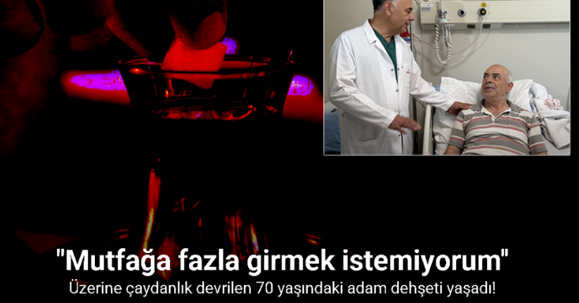 Üzerine çaydanlık devrilen 70 yaşındaki adam dehşeti yaşadı, vücudunun yüzde 20’si yandı