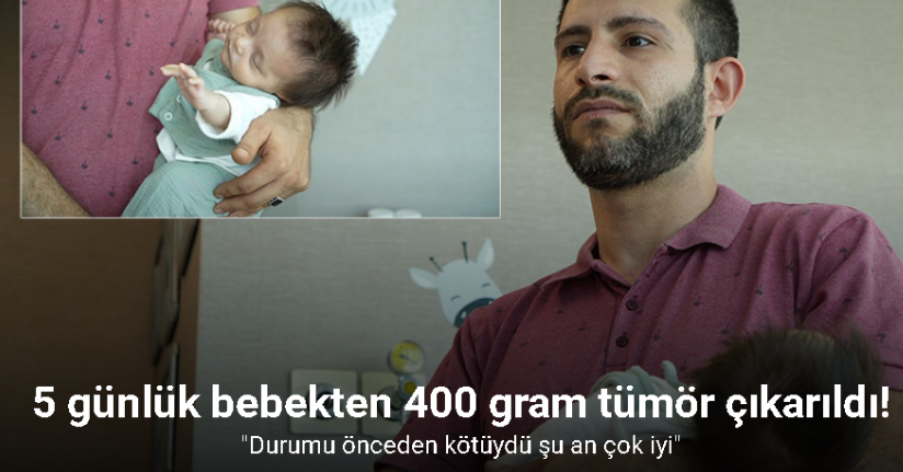 Ameliyat edilen 5 günlük bebek, 400 gramlık tümörün çıkarılmasıyla hayata tutundu