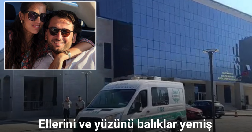 Ellerini ve yüzünü balıklar yemiş...