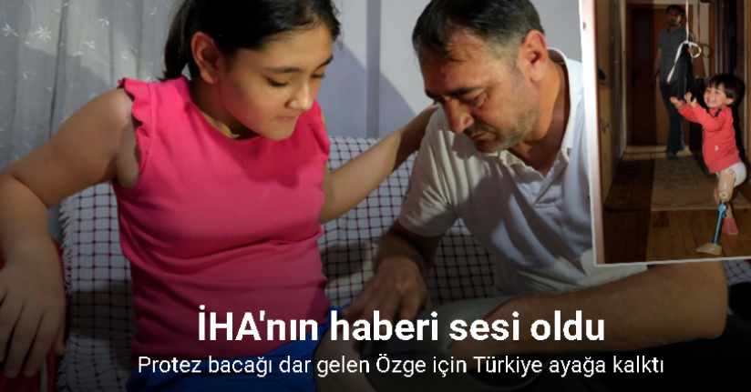 Protez bacağı dar gelen Özge için Türkiye ayağa kalktı