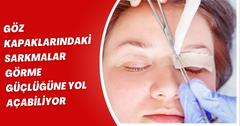 Göz kapaklarındaki sarkmalar görme güçlüğüne yol açabiliyor