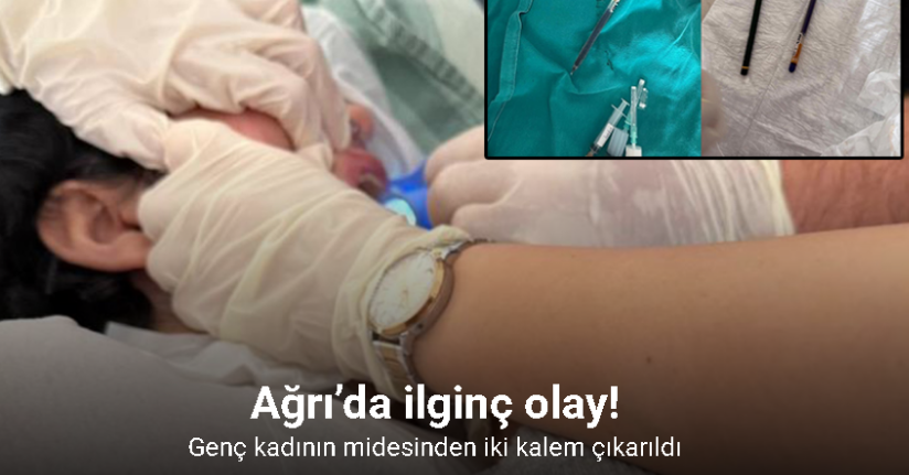 Ağrı’da genç kadının midesinden endoskopiyle iki kalem çıkarıldı