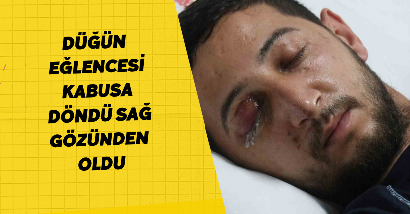 Düğün eğlencesi kabusa döndü: Sağ gözünden oldu