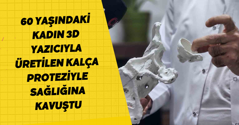 60 yaşındaki kadın 3D yazıcıyla üretilen kalça proteziyle sağlığına kavuştu