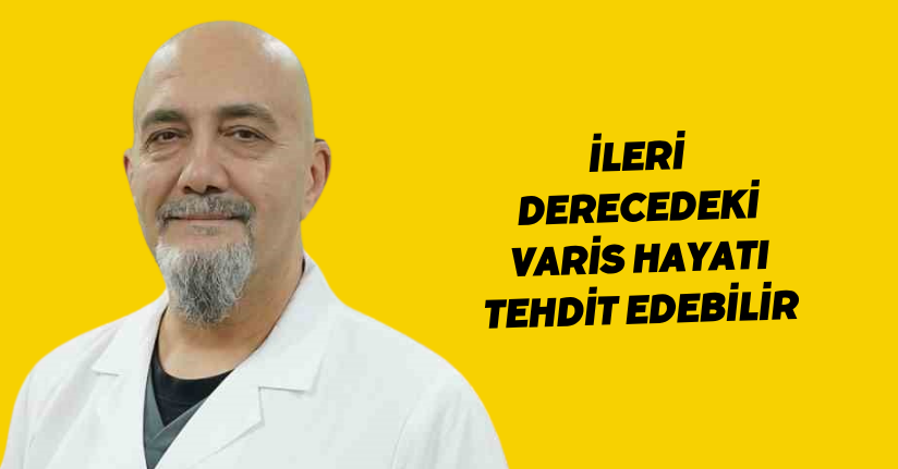 İleri derecedeki varis hayatı tehdit edebilir