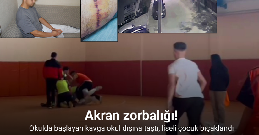 Okulda başlayan kavga okul dışına taştı, liseli çocuk bıçaklandı