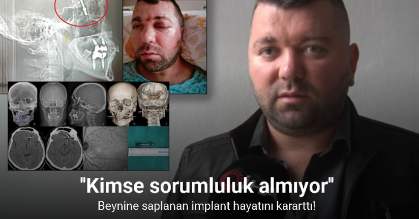 Beynine saplanan implant hayatını kararttı: 2 yıldır adalet bekliyor