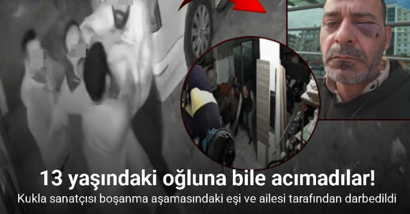 Kukla sanatçısı boşanma aşamasındaki eşi ve ailesi tarafından darbedildi