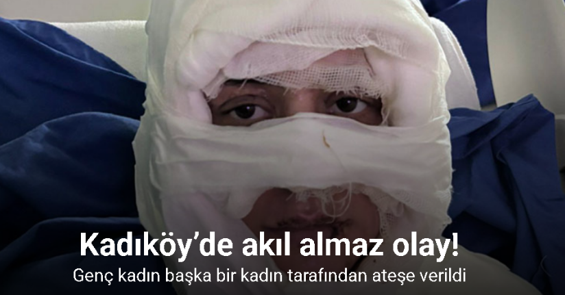 Kadıköy’de akıl almaz olay: Genç kadın başka bir kadın tarafından ateşe verildi