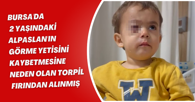 Bursa'da, 2 yaşındaki Alpaslan'ın görme yetisini kaybetmesine neden olan torpil, fırından alınmış