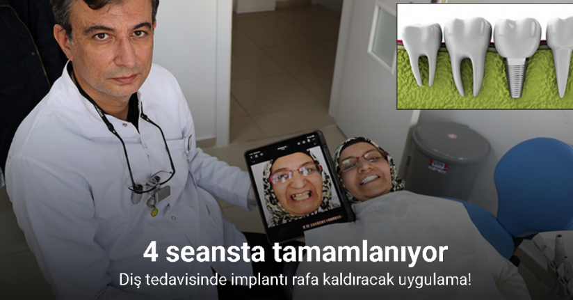 Depremlerden etkilendi, diş tedavisinde implantı rafa kaldıracak cam fiber uygulamasını geliştirdi
