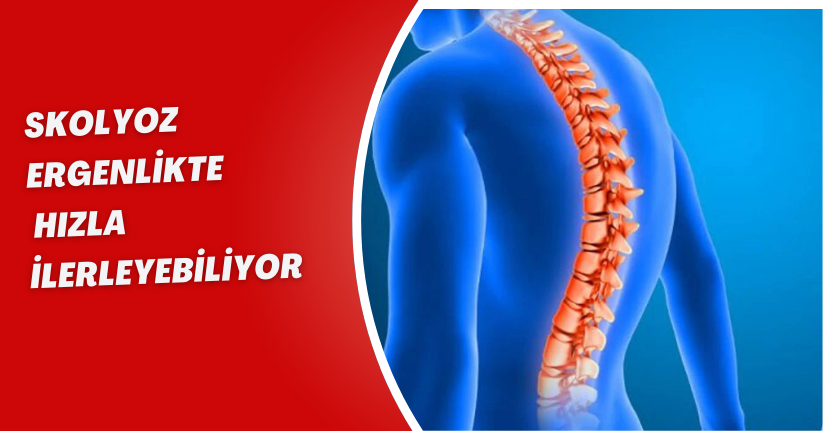 Skolyoz ergenlikte hızla ilerleyebiliyor