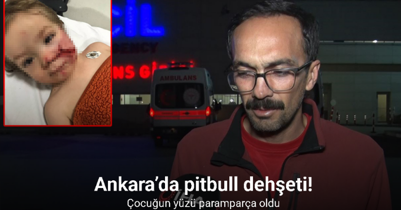 Ankara’da pitbull dehşeti: Çocuğun yüzü paramparça oldu